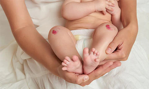 Why Every Parent Needs Baby Knee Pads for Crawling